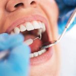 Durable traditional metal braces for effective teeth straightening